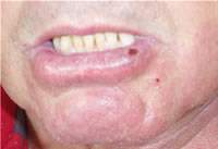 QUEILITS ACTIICA.jpg