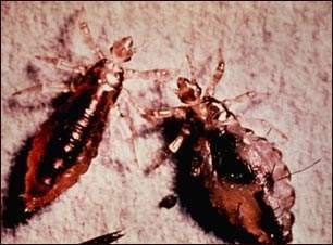 Archivo:Fiebre de las trincheras 2608.jpg