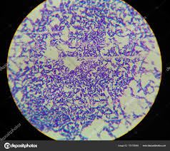 Bacilosgrampositivos.jpg