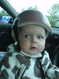 Síndrome de Adams..jpg