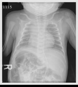 Heterotaxia 70544.jpg