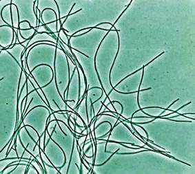 Chloroflexus aurantiacus.jpg