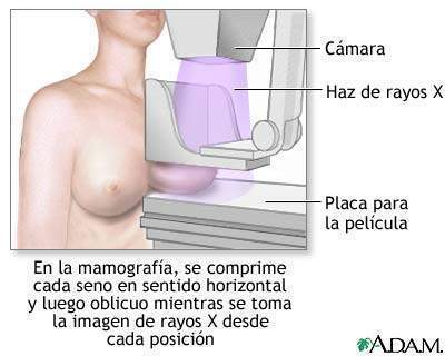 Mamografía - EcuRed