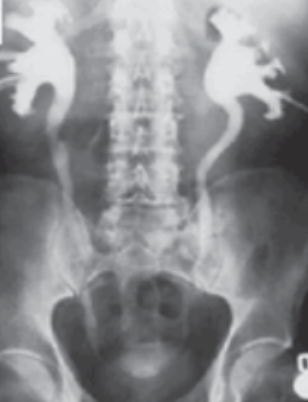 Archivo:Figura 2.17.png