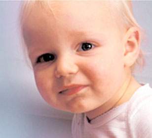 Archivo:Allergicbaby 1.jpg