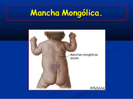 Mancha mongolica azul.jpg
