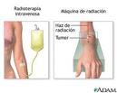 Radiación.jpg