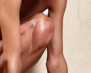 Osificaci'on hetero.jpg