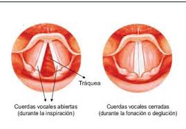 Disfonía hipocinética.jpg