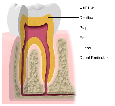 Archivo:Enfermedad pulpar y periapical.gif