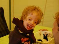 Síndrome de Marshall-Smith.jpg