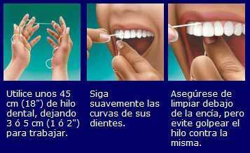 Usar el hilo dental.jpg