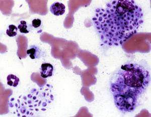 Virus Esporotricosis esacademic.jpg