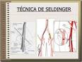 Seldinger.jpg