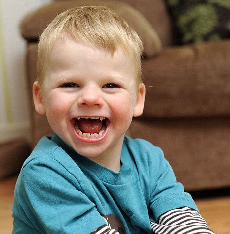 Archivo:Sindrome angelman1.jpg