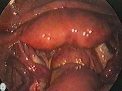 Archivo:Utero arcuato.jpg