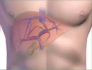 Tumor del hígado.jpeg