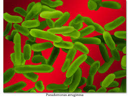 Pseudomonas .jpeg