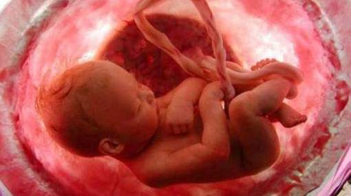 Archivo:Falta-de-liquido-amniotico.jpg