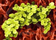 Staphylococcus bacte rium.jpg