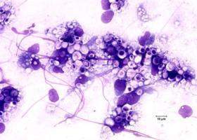 Archivo:Criptoco en felinos .jpg