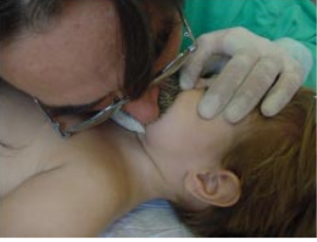 Archivo:Vía aérea artificialfig 53.1.1.png