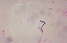 Streptococcus.jpg