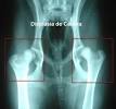 Displasia de cadera en perrospe.jpeg