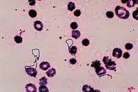 Streptococcus viridans.jpg