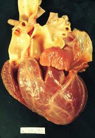 Ventrículo único índice.jpeg