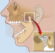 Disfunción temporomandibular.jpg