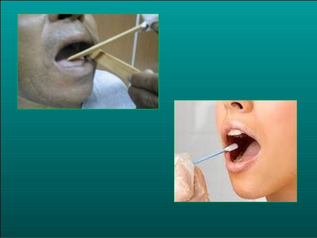 Archivo:Frotis bucal.jpg