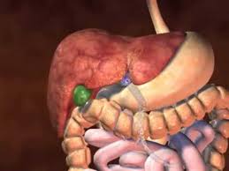 Corte de digestión.jpg