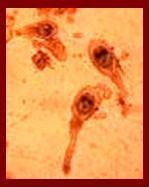 Cisticercoide.JPG