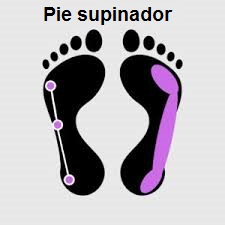 Pie supinador.jpg
