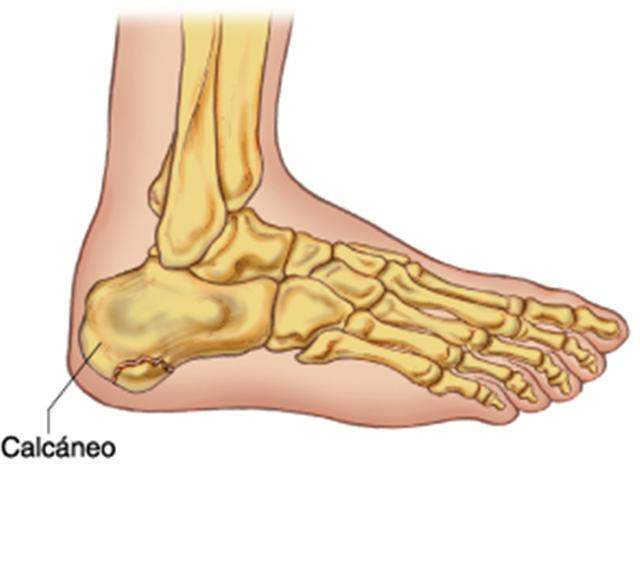Calcáneo EcuRed