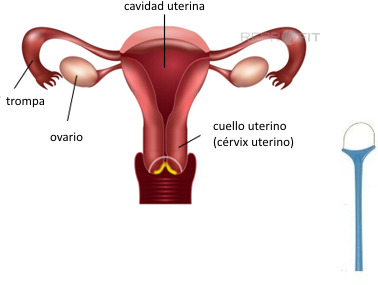 Archivo:Cornizacion cuello.jpg