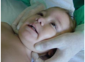 Archivo:Vía aérea artificial fig 53.5.png