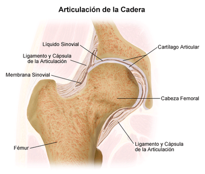 Archivo:Displasia congénita de la cadera .png