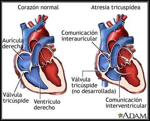 Archivo:Desarrollo-cardiopatias-congenitas image003.jpg