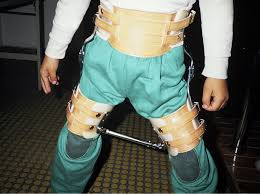 Enfermedad de perter.jpg