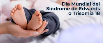 Archivo:Día Mundial del Síndrome de Edwards.jpg