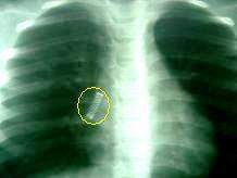 Cuerpos extraños.jpg