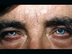 Enfermedad de Cogan.png