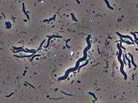 Bacterias espirilares.jpg