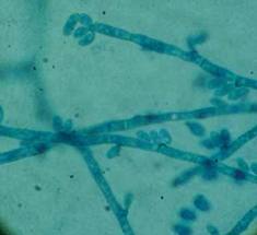 Hongo dematiaceo2.jpeg