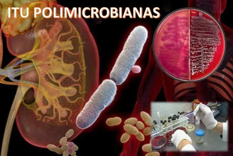 Infecciones polimicrobianas - EcuRed