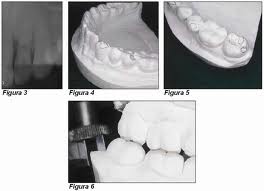 Archivo:Disfunción neuromusculares en la boca.jpeg