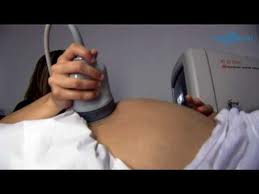 Ecografía Abdominal01.jpeg