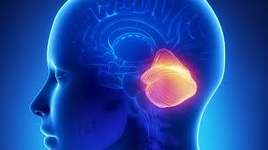 Síndrome Arnold Chiari.jpg